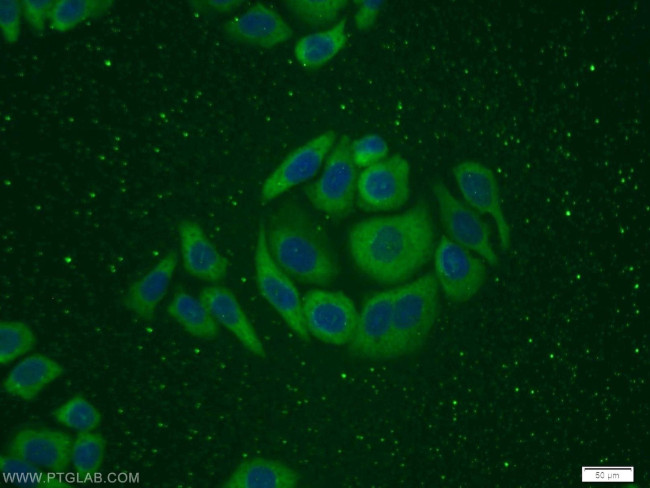 ITGB1BP1 Antibody in Immunocytochemistry (ICC/IF)