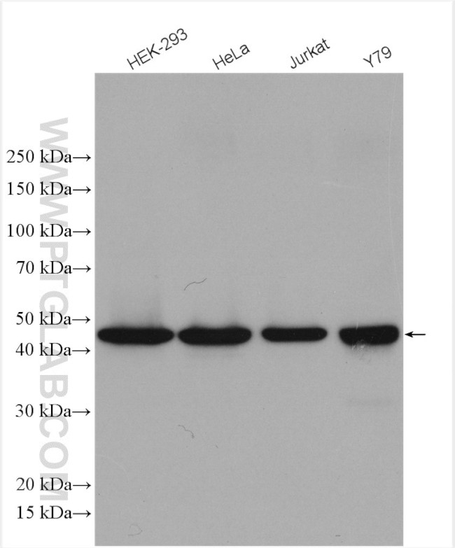 ASCC1 Antibody in Western Blot (WB)