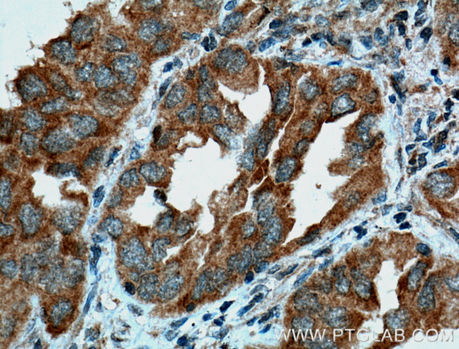 PDCD6 Antibody in Immunohistochemistry (Paraffin) (IHC (P))