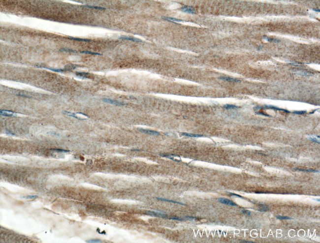 CRB3 Antibody in Immunohistochemistry (Paraffin) (IHC (P))