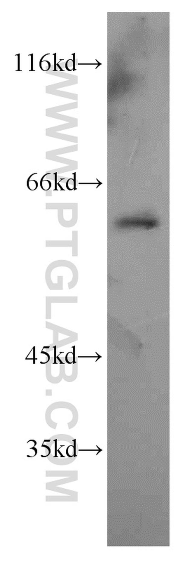 NETO2 Antibody in Western Blot (WB)