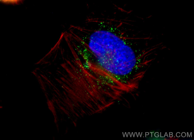 ACAA1 Antibody in Immunocytochemistry (ICC/IF)