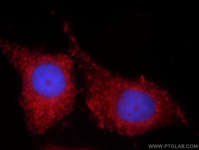 TIMP-4 Antibody in Immunocytochemistry (ICC/IF)