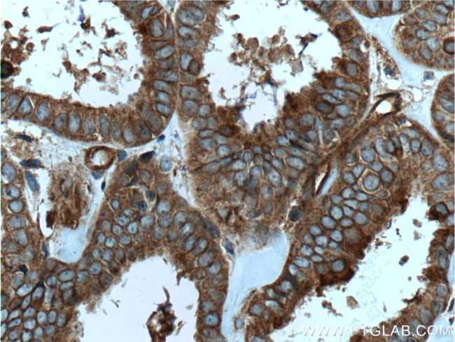 RALB Antibody in Immunohistochemistry (Paraffin) (IHC (P))