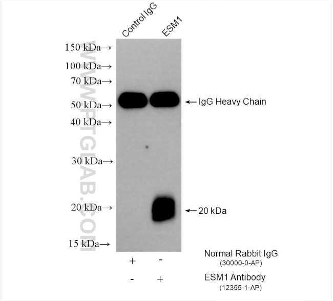 ESM1 Antibody in Immunoprecipitation (IP)