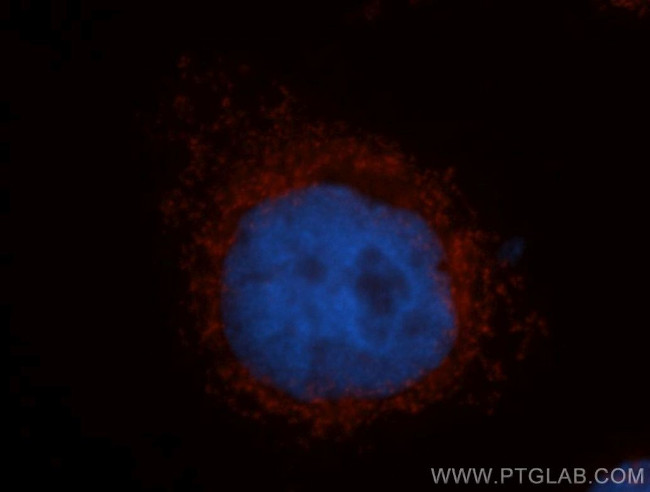 MRRF Antibody in Immunocytochemistry (ICC/IF)