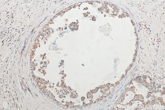 SYTL2 Antibody in Immunohistochemistry (Paraffin) (IHC (P))