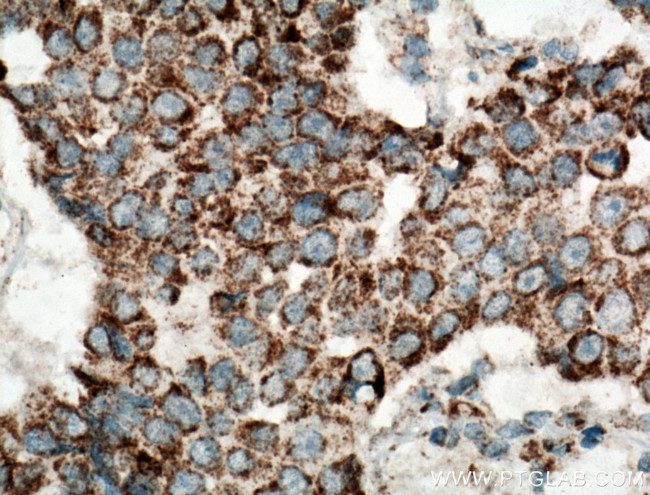UQCRH Antibody in Immunohistochemistry (Paraffin) (IHC (P))