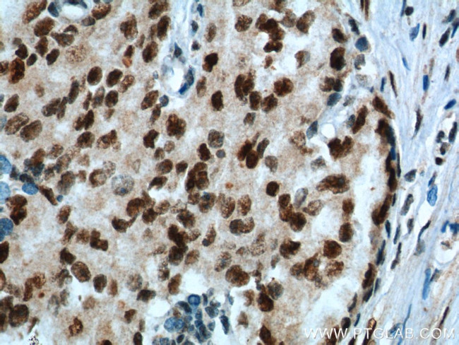 KPNA6 Antibody in Immunohistochemistry (Paraffin) (IHC (P))