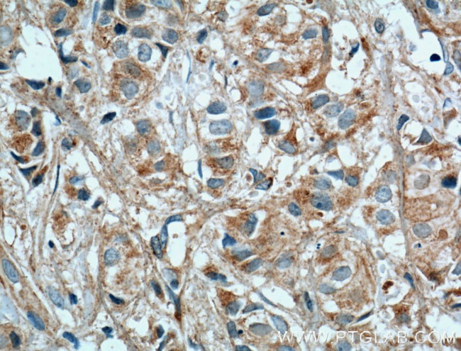 TSKU Antibody in Immunohistochemistry (Paraffin) (IHC (P))
