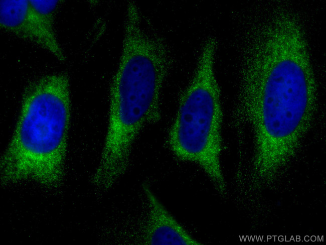 SNX12 Antibody in Immunocytochemistry (ICC/IF)