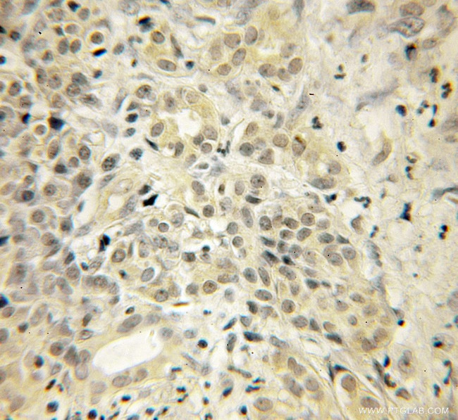 UCHL3 Antibody in Immunohistochemistry (Paraffin) (IHC (P))