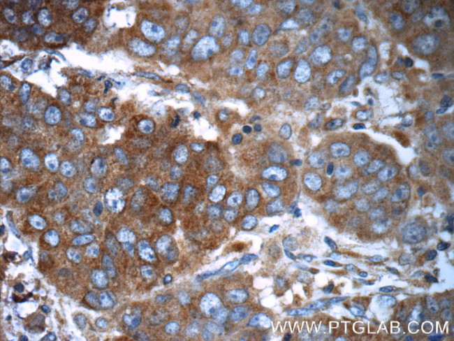 RAF1 Antibody in Immunohistochemistry (Paraffin) (IHC (P))