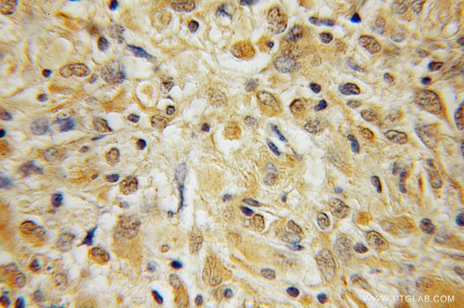 BEX1/2 Antibody in Immunohistochemistry (Paraffin) (IHC (P))