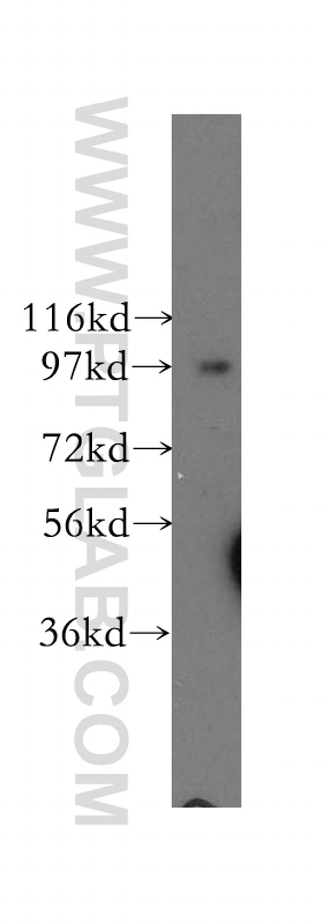 COPG Polyclonal Antibody (12393-1-AP)