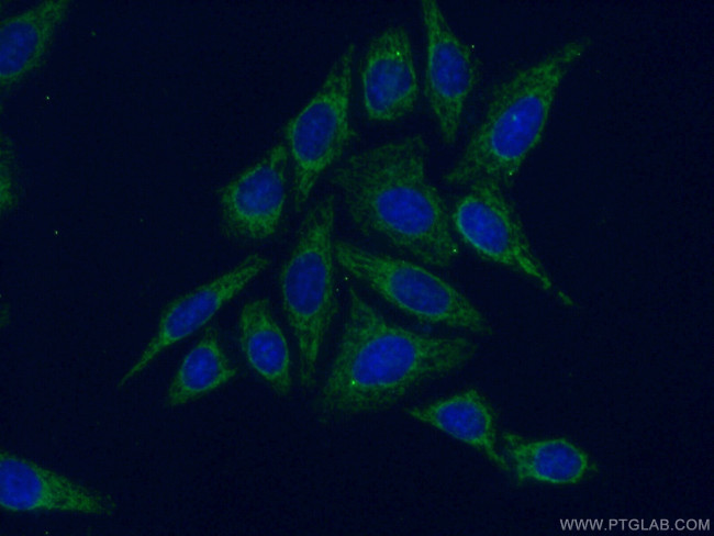 HGSNAT Antibody in Immunocytochemistry (ICC/IF)