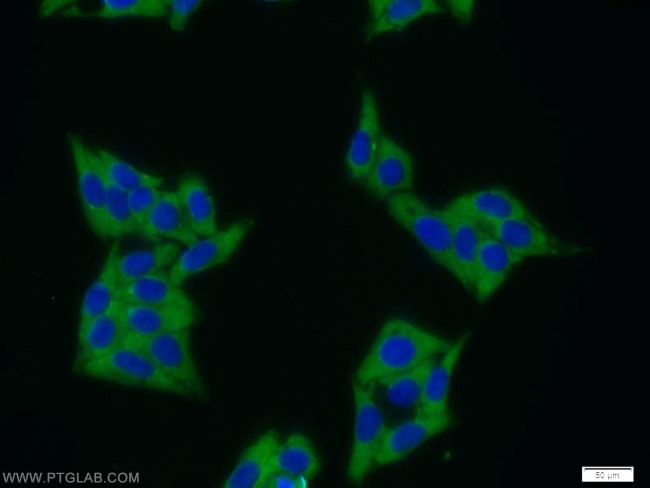 MAGEB1 Antibody in Immunocytochemistry (ICC/IF)
