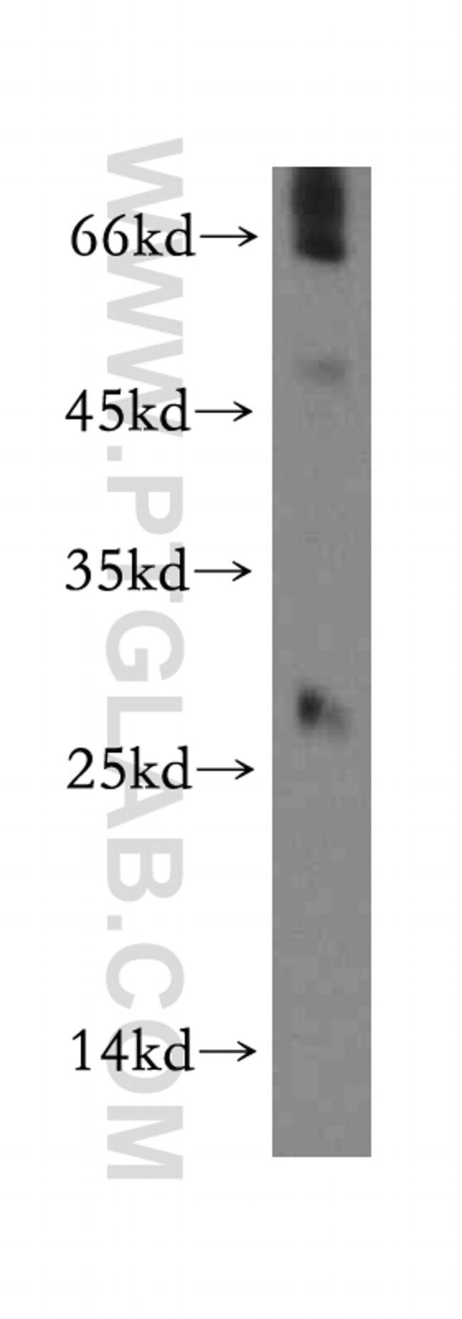 SSX5 Antibody in Western Blot (WB)