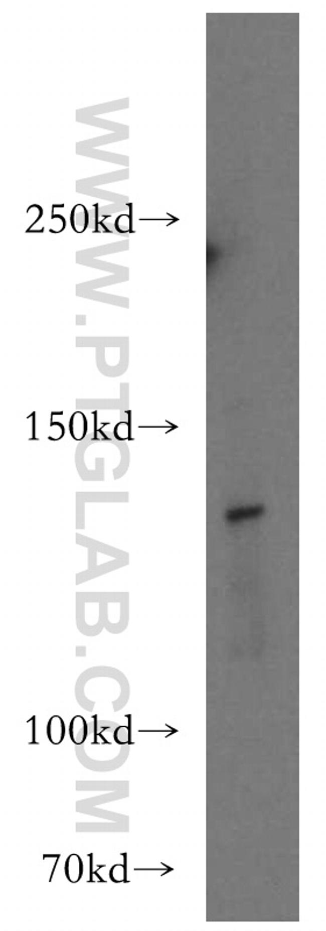 GEMIN4 Antibody in Western Blot (WB)