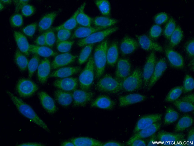 GSTM1 Antibody in Immunocytochemistry (ICC/IF)