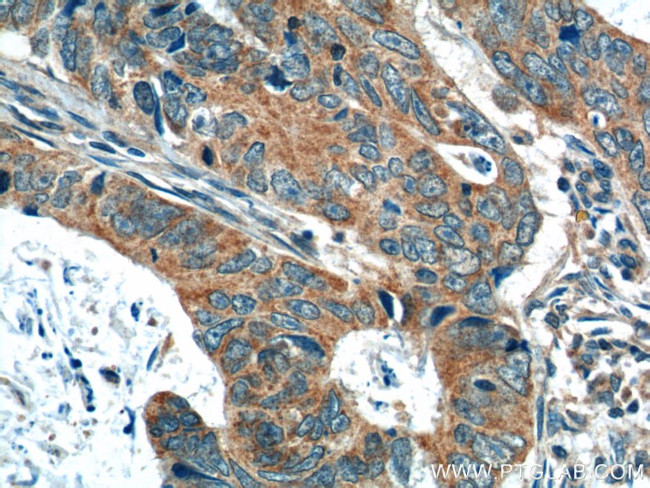 OSBPL3 Antibody in Immunohistochemistry (Paraffin) (IHC (P))