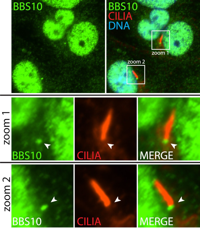BBS10 Antibody in Immunocytochemistry (ICC/IF)