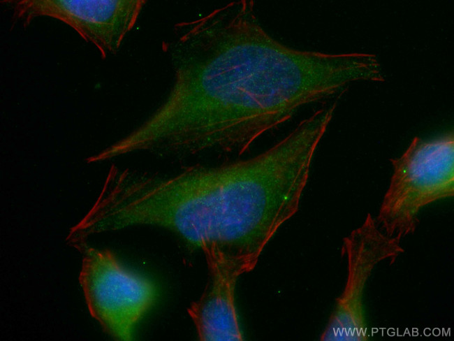 GLYCTK Antibody in Immunocytochemistry (ICC/IF)