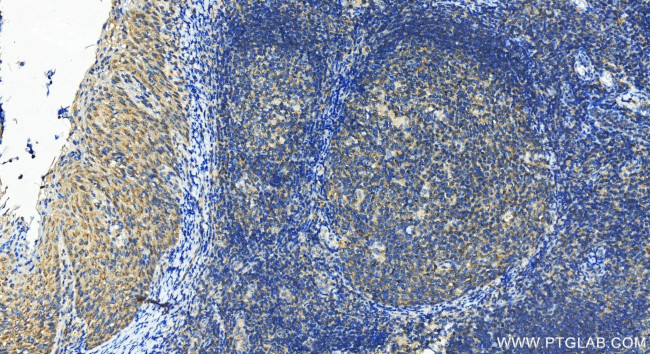 CDC42SE1 Antibody in Immunohistochemistry (Paraffin) (IHC (P))