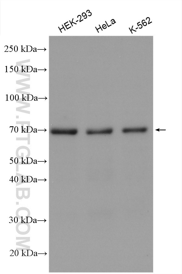 RPA1 Antibody in Western Blot (WB)