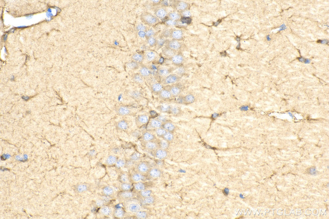 GPAM Antibody in Immunohistochemistry (Paraffin) (IHC (P))
