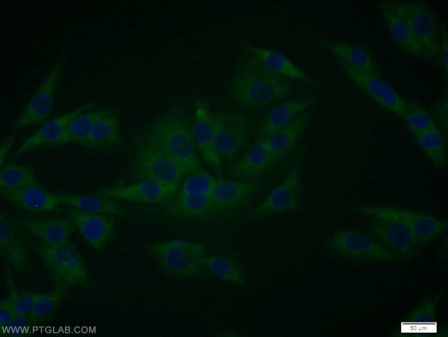 EPS8 Antibody in Immunocytochemistry (ICC/IF)