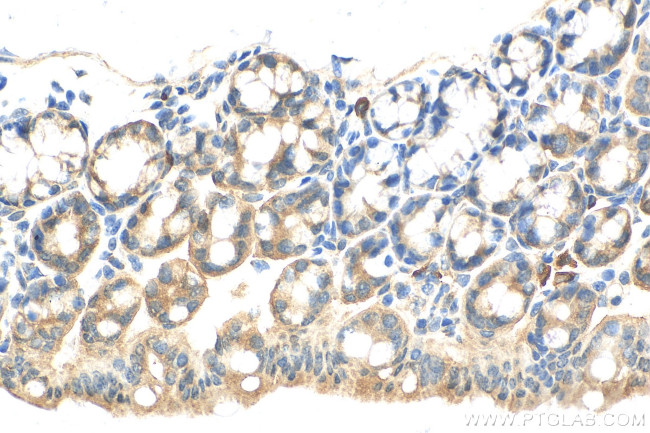 HOOK2 Antibody in Immunohistochemistry (Paraffin) (IHC (P))