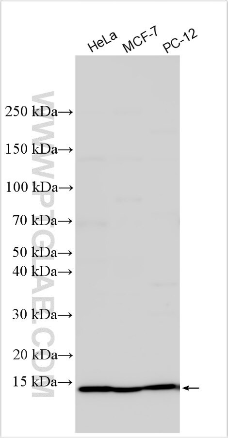 PPP1R1A Antibody in Western Blot (WB)