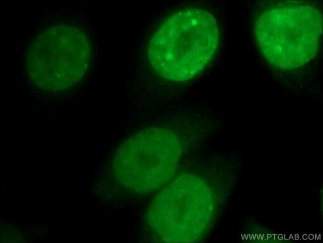 CDCA8 Antibody in Immunocytochemistry (ICC/IF)
