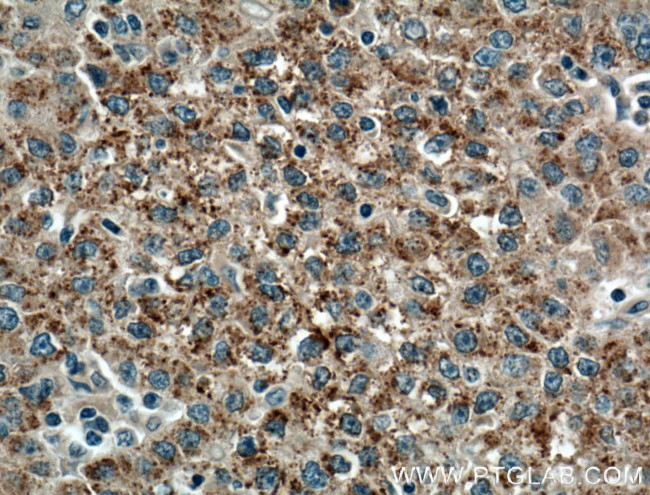 PANK1/2/3 Antibody in Immunohistochemistry (Paraffin) (IHC (P))
