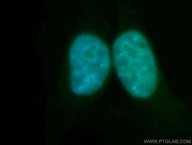 RECQL5 Antibody in Immunocytochemistry (ICC/IF)