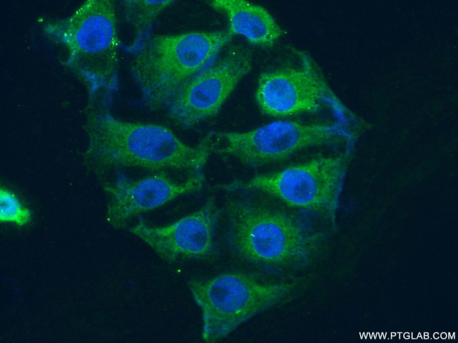 PIP4K2A Antibody in Immunocytochemistry (ICC/IF)
