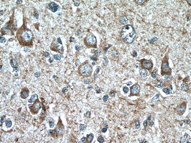 MOBP Antibody in Immunohistochemistry (Paraffin) (IHC (P))
