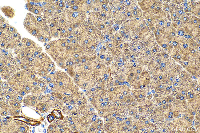 RIT2 Antibody in Immunohistochemistry (Paraffin) (IHC (P))