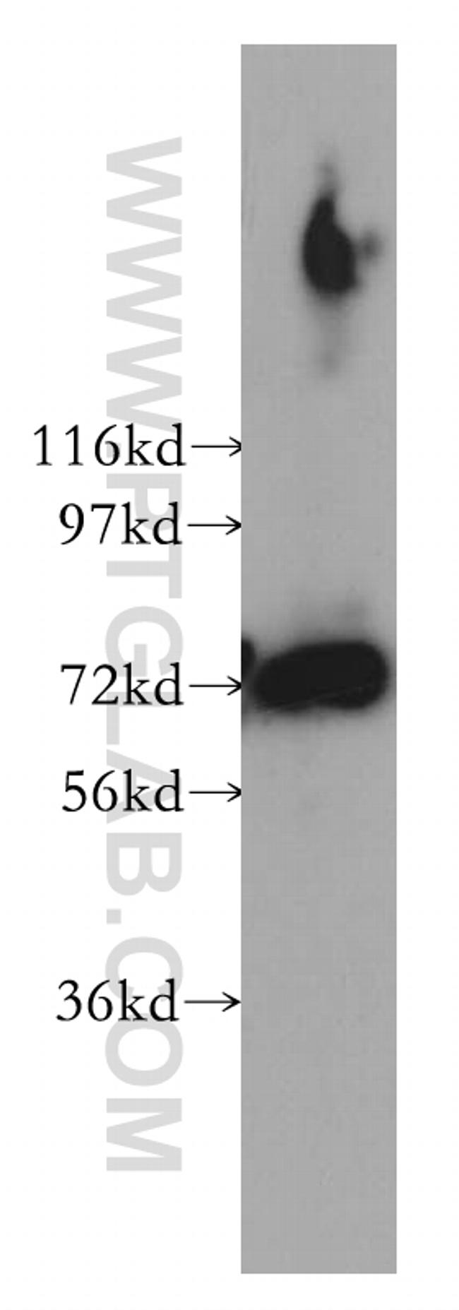 PREPL Antibody in Western Blot (WB)