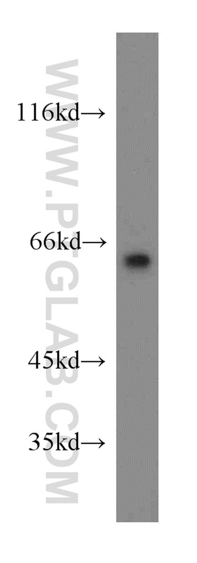 LGI1 Antibody in Western Blot (WB)