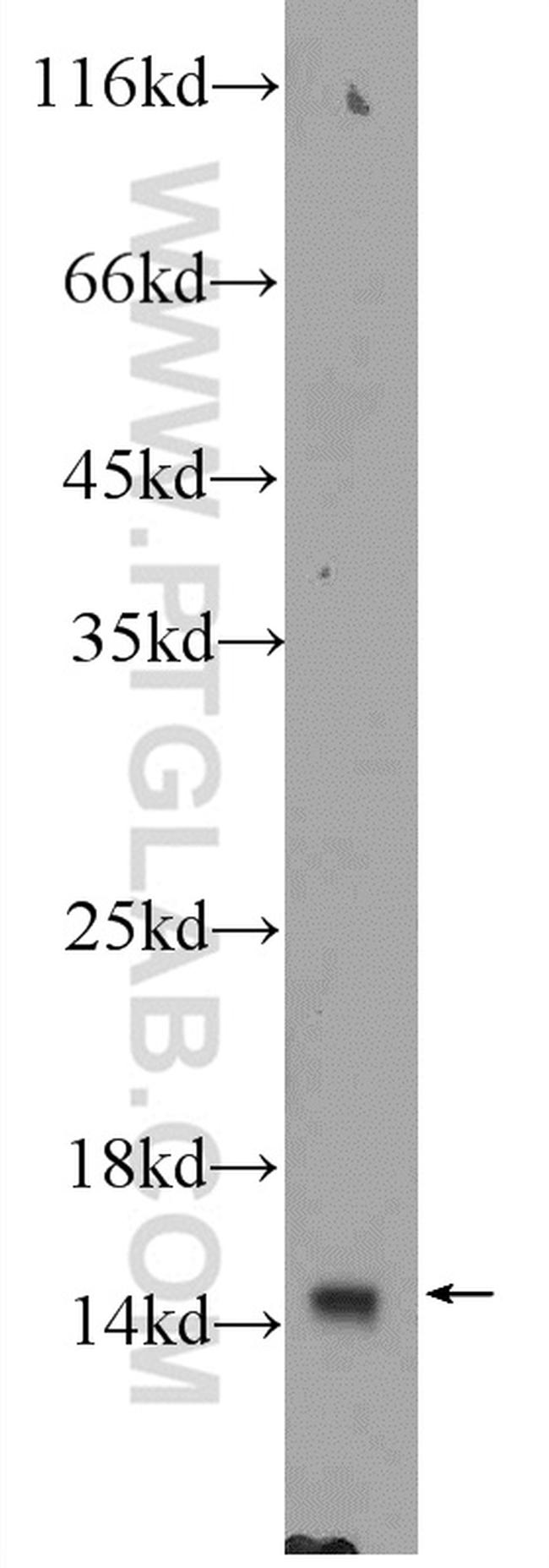 TRAPPC2 Antibody in Western Blot (WB)