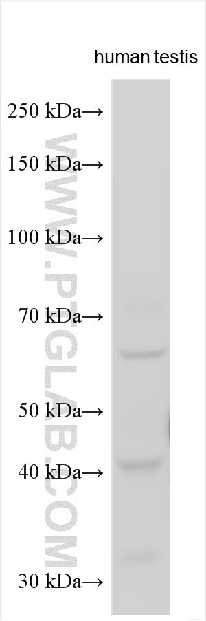 ACRBP Antibody in Western Blot (WB)