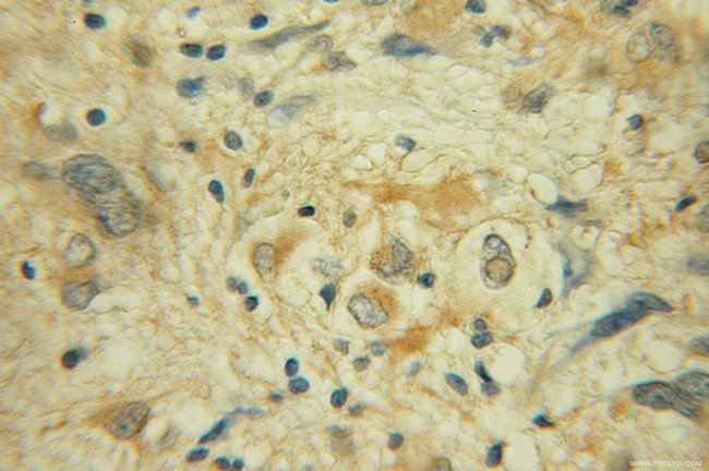 RGS3 Antibody in Immunohistochemistry (Paraffin) (IHC (P))