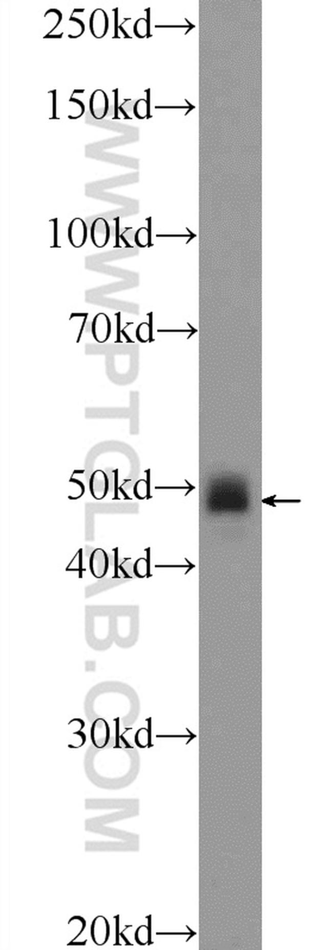 CHST1 Antibody in Western Blot (WB)