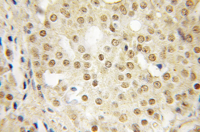 SFRS14 Antibody in Immunohistochemistry (Paraffin) (IHC (P))