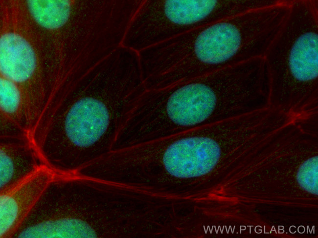 ZBTB32 Antibody in Immunocytochemistry (ICC/IF)