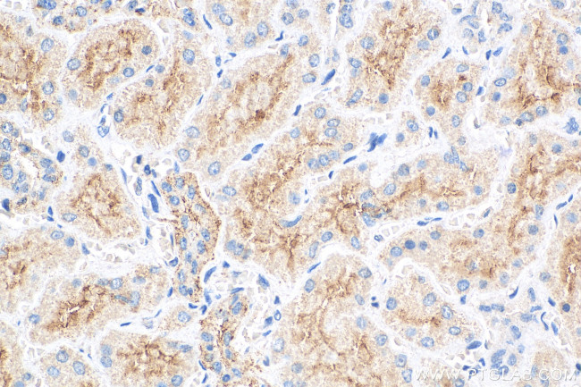 MAP17/PDZK1IP1 Antibody in Immunohistochemistry (Paraffin) (IHC (P))