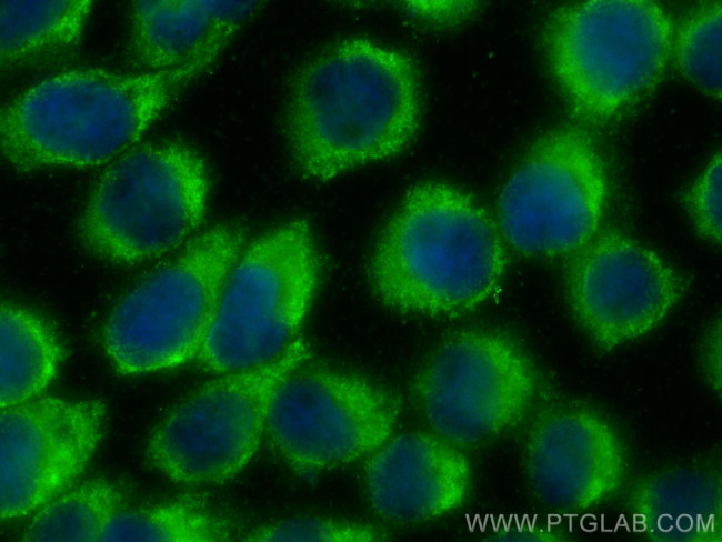 NANP Antibody in Immunocytochemistry (ICC/IF)
