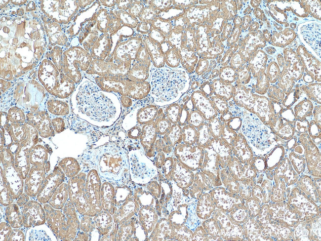 TMOD3 Antibody in Immunohistochemistry (Paraffin) (IHC (P))